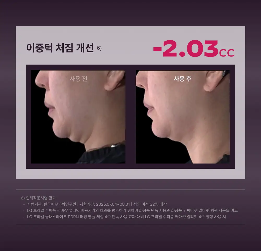[고주파 멀티디바이스] LG 프라엘 써마샷 얼티밋 상세페이지 38